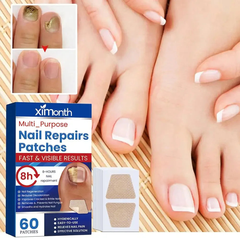 Adesivos de Reparação Discretos para Unhas com Fungos — foto 2