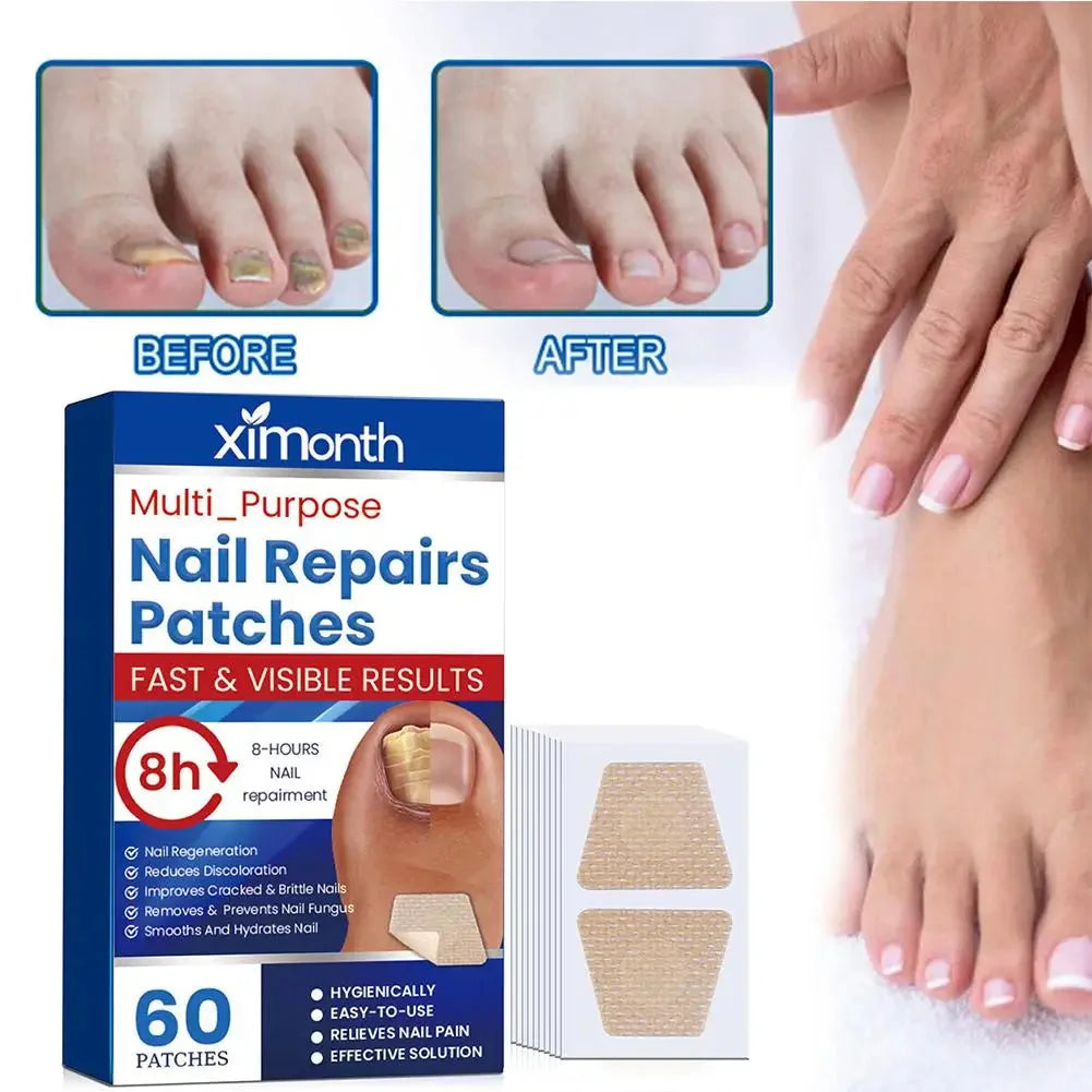 Adesivos de Reparação Discretos para Unhas com Fungos — foto 3